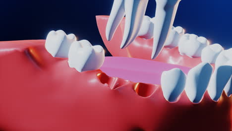 Zahnmedizinischer-Zahnimplantatprozess